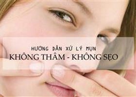 dai dien 1