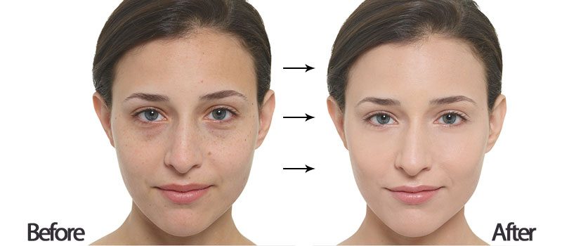 BB Cream che phủ hoàn hảo khuyết điểm cho lớp nền sáng mịn, đều màu, tự nhiên
