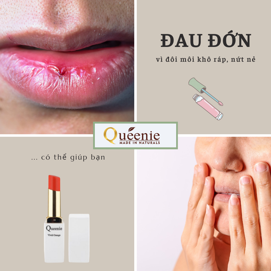 Son dưỡng môi Hàn Quốc 2 son dưỡng môi hàn quốc trị thâm